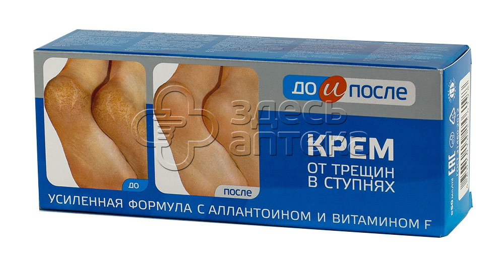 Крем для ног До и После от трещин в ступнях 50мл 199₽